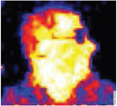Тепловизионное изображение человека в очках, смотрящего в сторону, полученное с помощью новой ИК термопарной матрицы 32x32.Для получения изображения использовался специализированное ПО ArraySoft от компании Heimann Sensor.